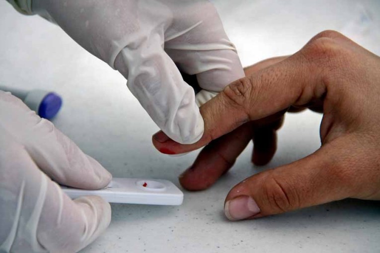 HIV